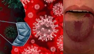 COVID alert! Second wave of infections comes with THESE symptoms, Here’s how to catch early signs
