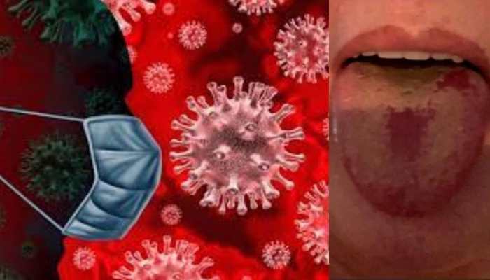 COVID alert! Second wave of infections comes with THESE symptoms, Here’s how to catch early signs