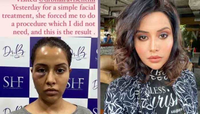 Tamil actress Raiza Wilson slaps legal notice on dermatologist after wrongful cosmetic procedure, seeks 1 cr compensation