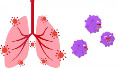  COVID-19: How the virus can affect your lungs