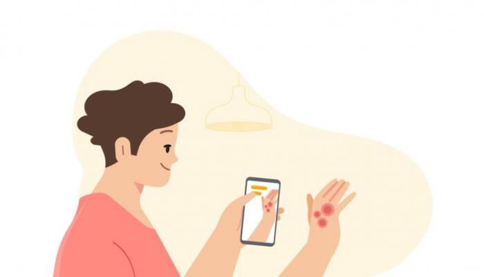 Google update! Use your smartphone to identify skin conditions at home