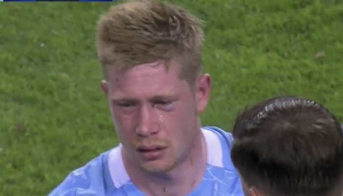 Champions League final: Antonio Rudiger&#039;s blow leaves Manchester City&#039;s Kevin De Bruyne with nose and eye socket fracture