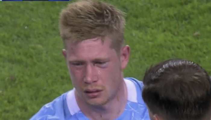 Champions League final: Antonio Rudiger's blow leaves Manchester City's Kevin De Bruyne with nose and eye socket fracture