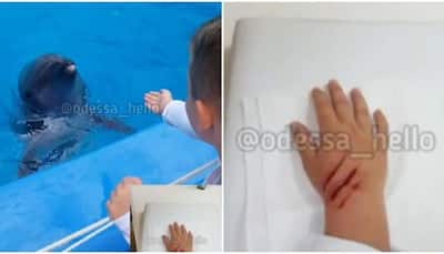 Terrifying! Dolphin bites little kid's hand, little boy gets three stitches 