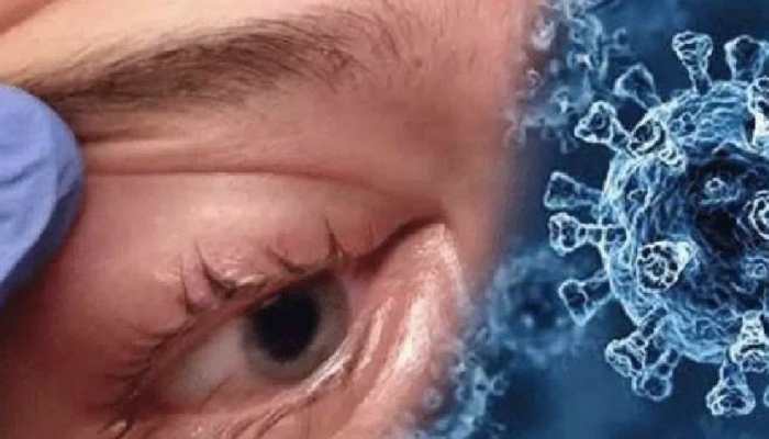 First ever case of &#039;Optic Neuritis&#039; after black fungus; Kanpur authorities on alert