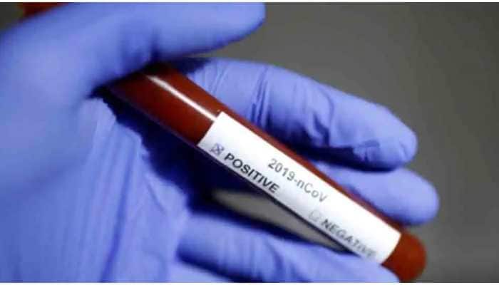 COVID-19: India sees 43,071 new infections and 955 deaths in 24 hours