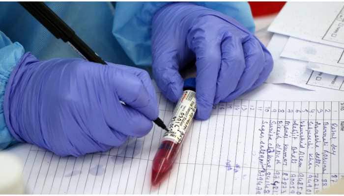 COVID-19: With 34,703 new cases, India sees lowest daily rise in over 110 days