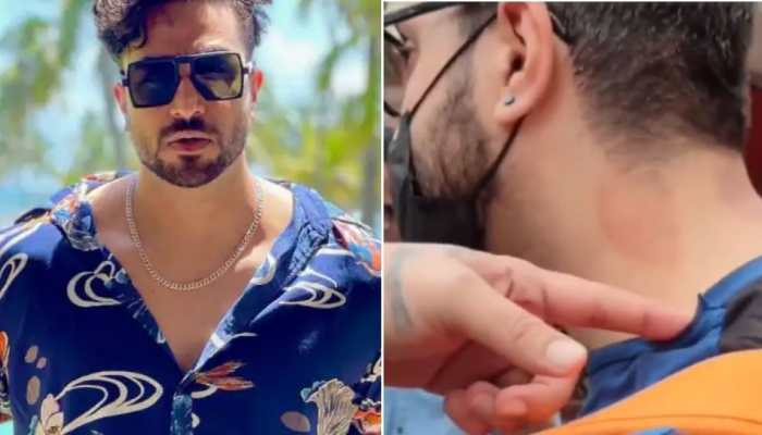  Lal lal kya hai: Paparazzi ask Aly Goni about &#039;red marks&#039; on his neck, actor has hilarious reply!