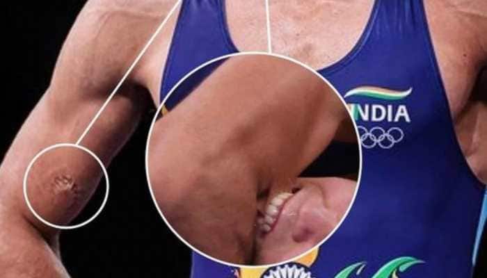 Tokyo Olympics: Furious Virender Sehwag says THIS about Ravi Dahiya ‘biting’ incident