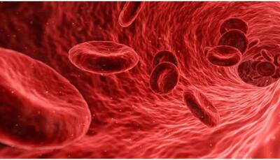 COVID-19 infection increases risk of blood clots during surgery, says study