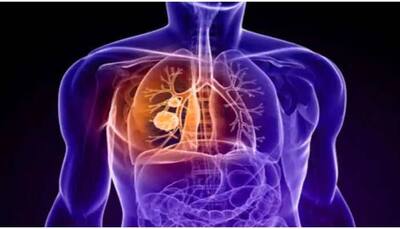 Short-lived lung infection may cause permanent lung damage, here's why