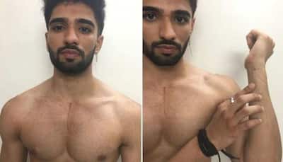 Bigg Boss OTT: Zeeshan Khan shares shocking pictures of scratch marks after his eviction!