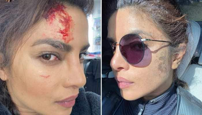 Priyanka Chopra gets wounded while shooting for Citadel - See pic