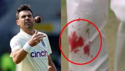 India vs England 4th Test: James Anderson bowls with bleeding knee, video goes viral - WATCH