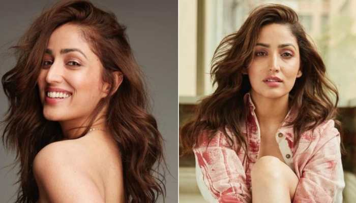 Yami Gautam opens up on 'insecurities' about her incurable skin condition, shares unedited pictures 