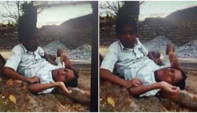 Conjoined twins of Chhattisgarh die under mysterious circumstances, old video surfaces