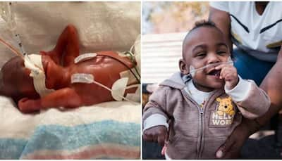 Meet the world's most premature baby, Curtis Zy-Keith, who was born at 21 weeks