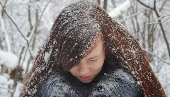 Get rid of dandruff this winter, with these 10 easy hacks!