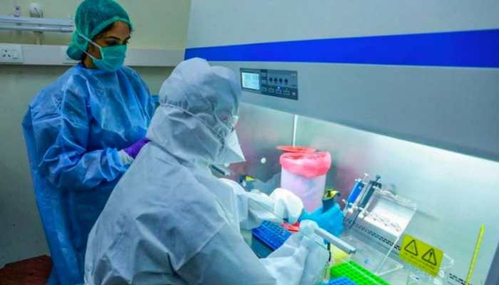 Scientists develop Covid-19 diagnosis test using X-rays- All you need to know 