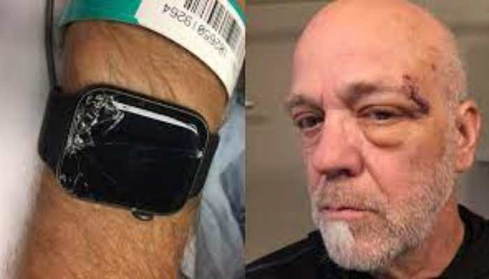 Unbelievable! Apple Watch saves THIS man's life, here's how