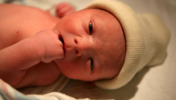 World Birth Defects Day: WHO seeks to raise awareness, intensifies measures for prevention of birth defects