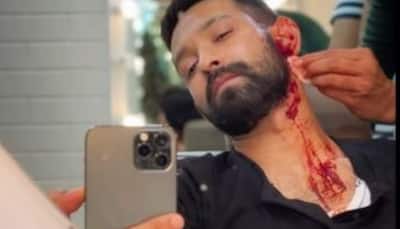 Vikrant Massey shares bloodied selfie, builds anticipation for his next film