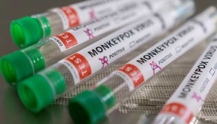 Monkeypox scare: Is Mumbai worried? BMC sets up special ward for suspected cases