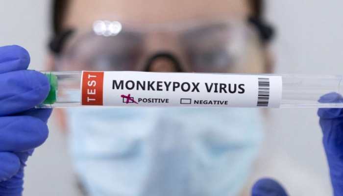 Monkeypox contracted by only gay, bisexual men? 5 myths about the viral infection BUSTED!