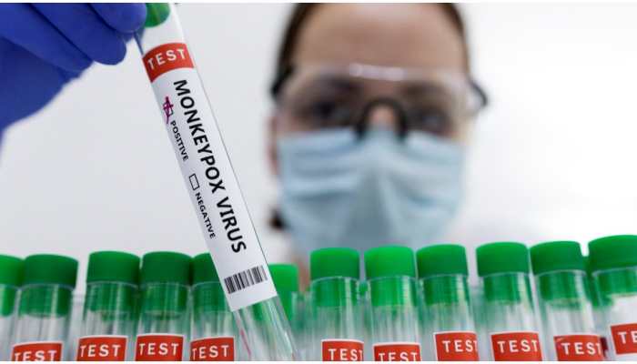 Monkeypox outbreak: Private Indian firm develops RT-PCR based kit to detect virus