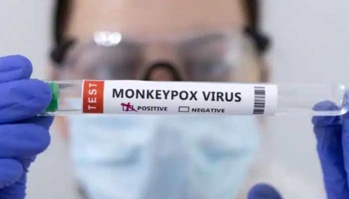 Monkeypox virus detected in Argentina; two confirmed cases