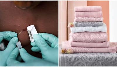 Monkeypox Virus Outbreak: Disease can spread to another person from clothes, towels and...