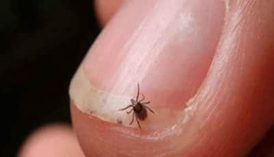 Scrub Typhus: Over 80 people in Bengal reportedly infected - causes and symptoms