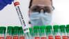 Monkeypox worry increases! Health agency in England say there's community spread