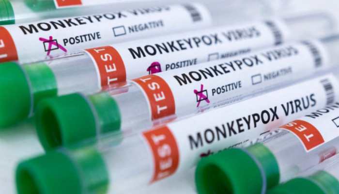 Monkeypox scare! 5-year-old Ghaziabad girl's samples sent for testing as precautionary step
