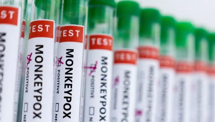 Monkeypox: THIS country reports 77 more viral cases, biggest outbreak outside Africa Monkeypox: THIS country reports 77 more viral cases, biggest outbreak outside Africa