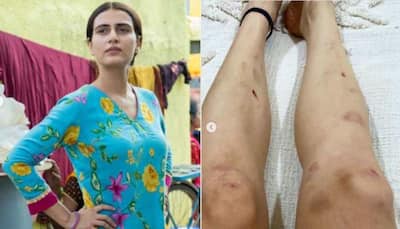  Fatima Sana Shaikh gets emotional as she shares her bruises from the sets of Modern Love Mumbai