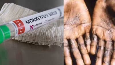 Monkeypox virus outbreak: German panel recommends vaccines as cases cross over 1000 globally