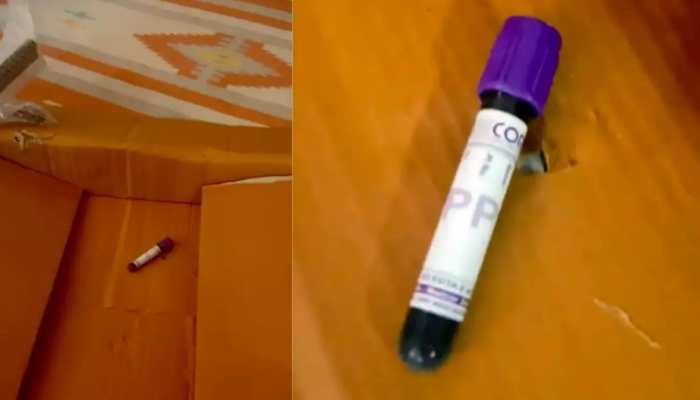 Bizarre Incident! Woman orders chair on Amazon, gets vial of blood