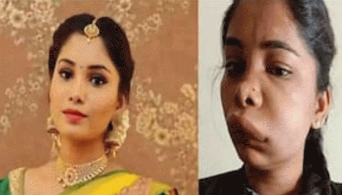 SHOCKING! Kannada actress Swathi Sathish&#039;s root canal surgery goes terribly wrong, gets badly swollen face