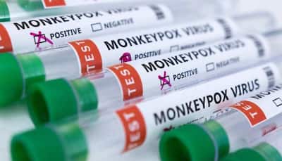 Monkeypox virus outbreak: US on alert, ramps up testing amid 142 confirmed cases