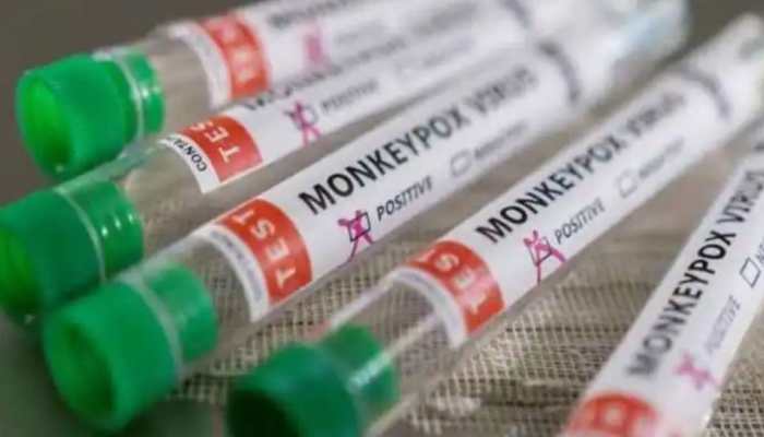 Is Monkeypox virus mutating more rapidly than expected? Here's what researchers say
