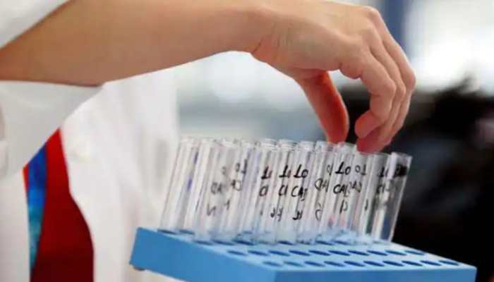 Bangladeshi students may soon need to take dope test for university admissions