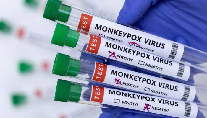 'Monkeypox cases tripled in two weeks in...': WHO's BIG warning on viral outbreak