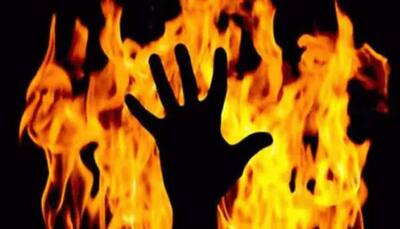 Madhya Pradesh: Tribal woman battles for life after being set ablaze in Guna, 2 arrested