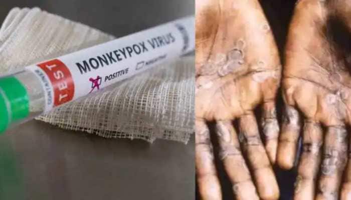 Was Monkeypox outbreak avoidable? Expert makes shocking revelation