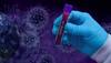 BIG Covid update! Nasal spray lowers viral load by 94 per cent in 24 hours, says Lancet study