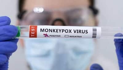 India reports its FIRST Monkeypox case, Kerala health dept issues guidelines - check causes and symptoms