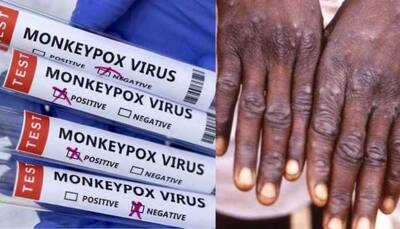 Monkeypox enters India: Guidelines issued for international travellers - check symptoms, prevention, treatment 
