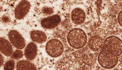 Monkeypox scare: Second positive case confirmed in Kerala's Kannur 
