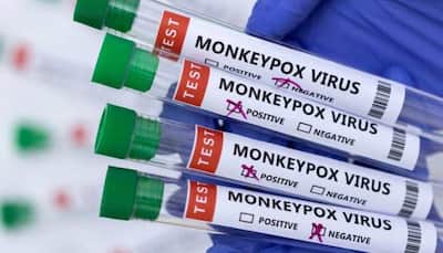 Monkeypox in children! US reports its first 2 cases of viral infection in kids